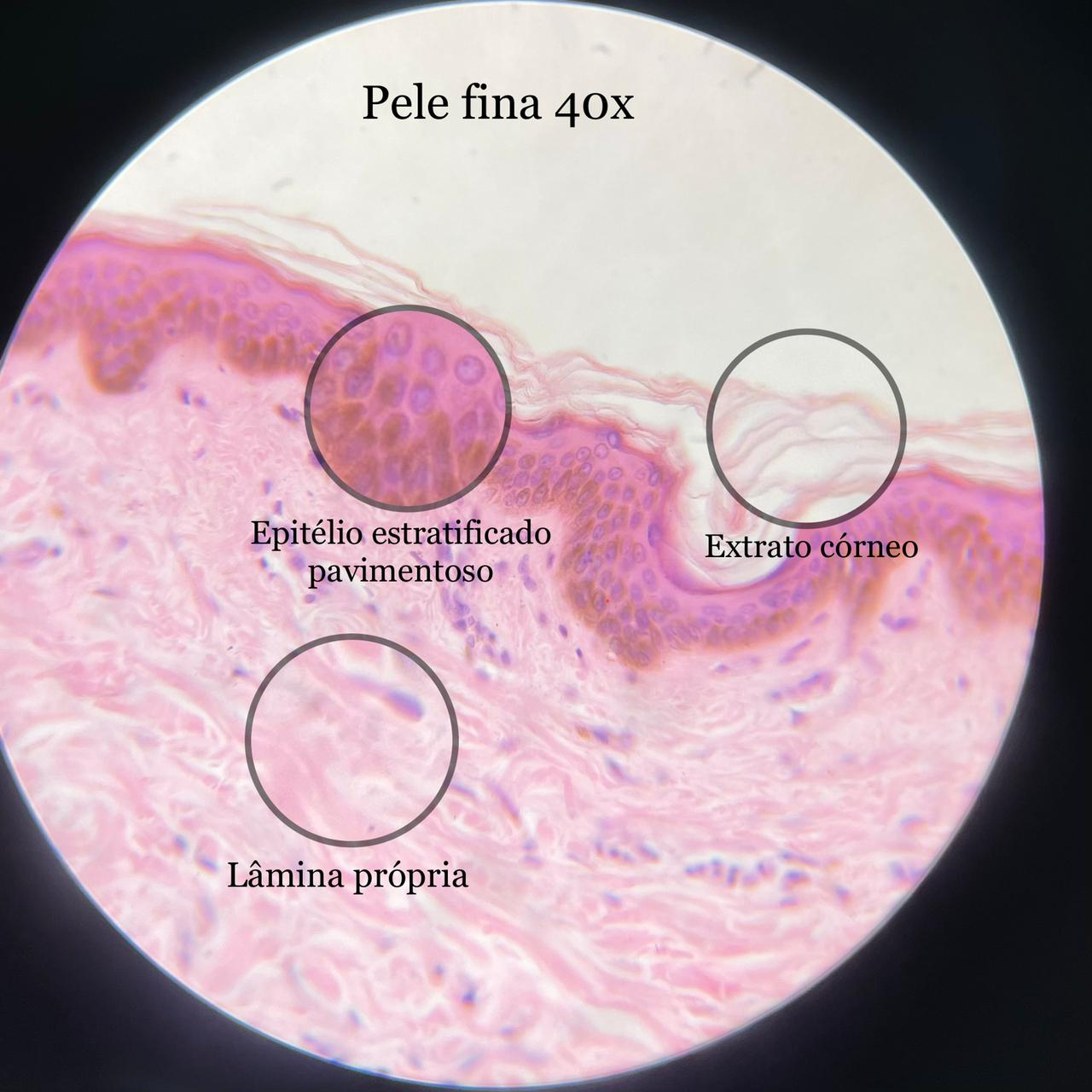 Pele fina