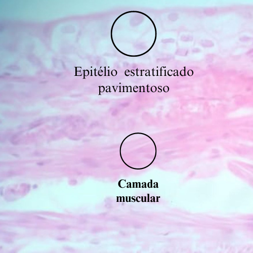 Pele grossa (4).png