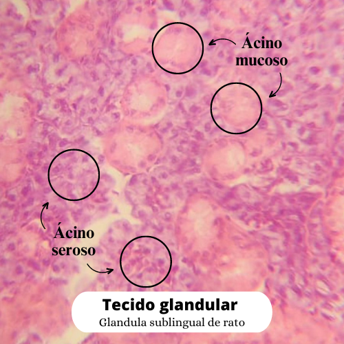Tecido glandular (1).png